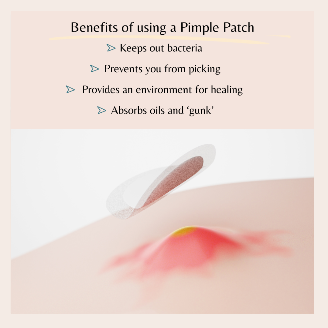 108 Hydrocolloid Pimple Patches